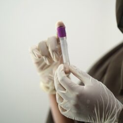 HIV-Selbsttest - Antikörper Speicheltest für zu Hause