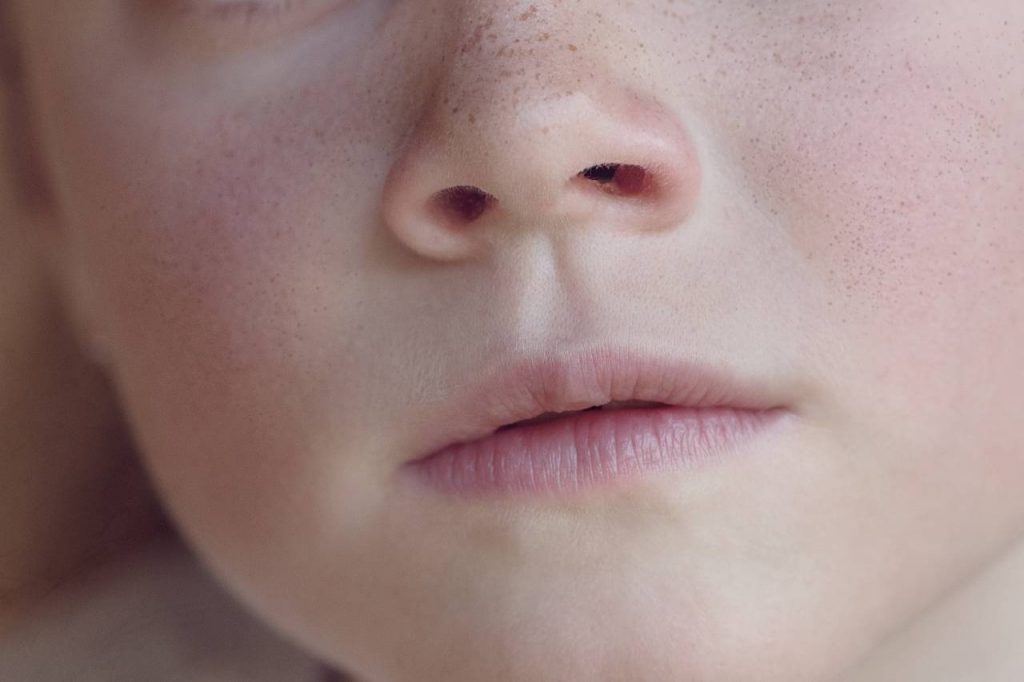 Was tun bei Nasenpolypen? - mediclife.de