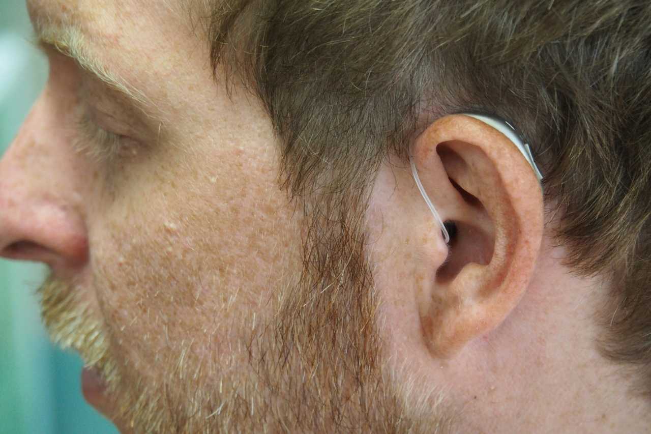 Tinnitus-Therapie – Ursachen, Behandlung